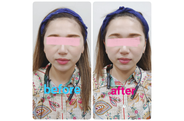 sketch-1583488763349